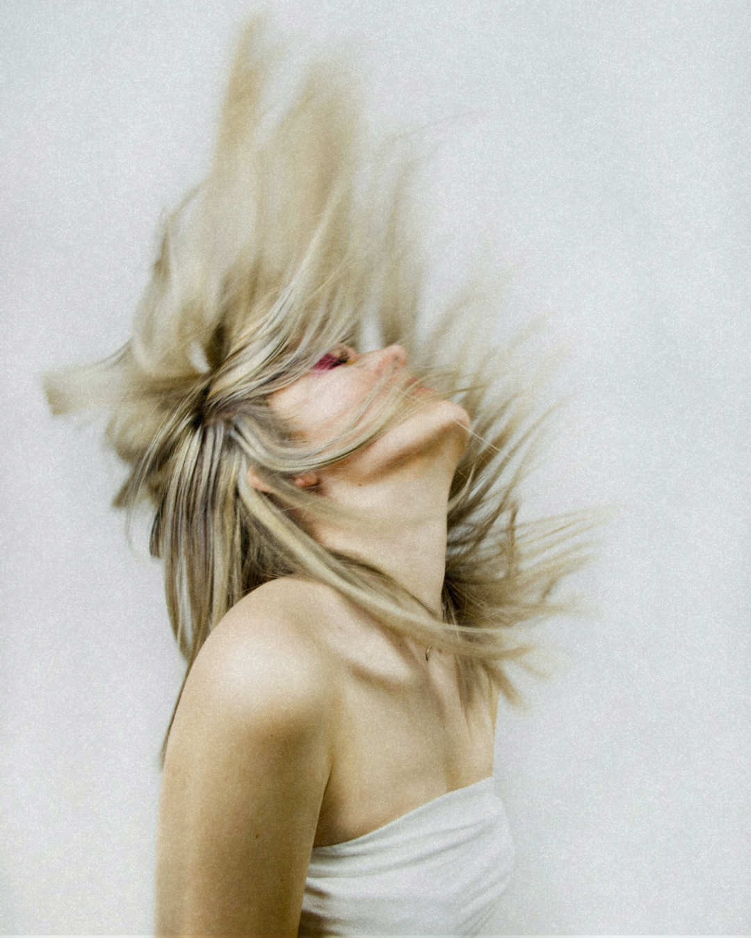 Hormonal Hair Loss
