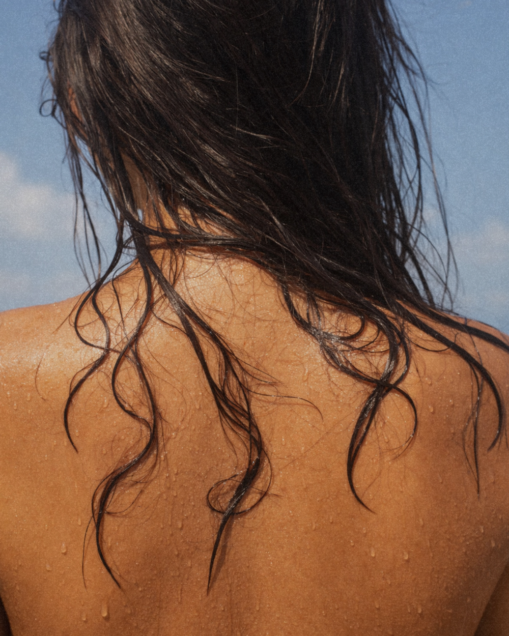 Summer Hair Loss: Is It Normal?